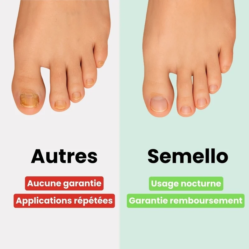 Patch et Sérum contre les Mycoses des Ongles
