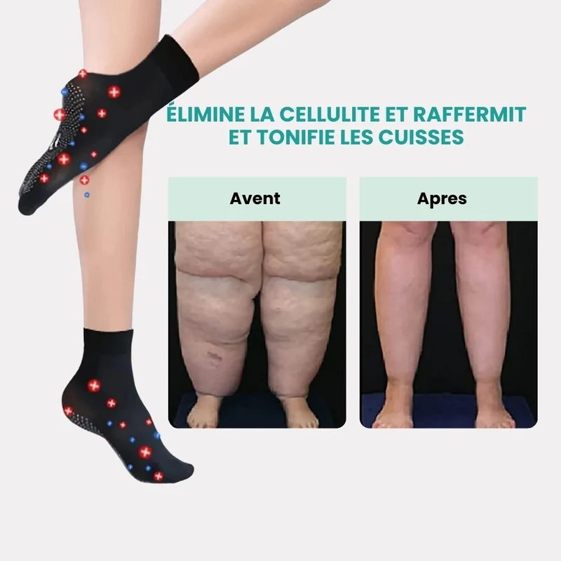 Chaussettes de Massage Minceur – Massage & Circulation