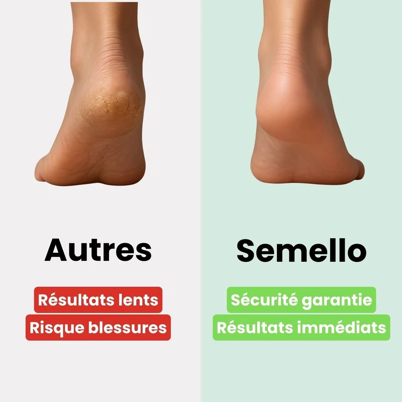 Râpe à Pieds Professionnelle – Élimine Callosités & Peaux Mortes