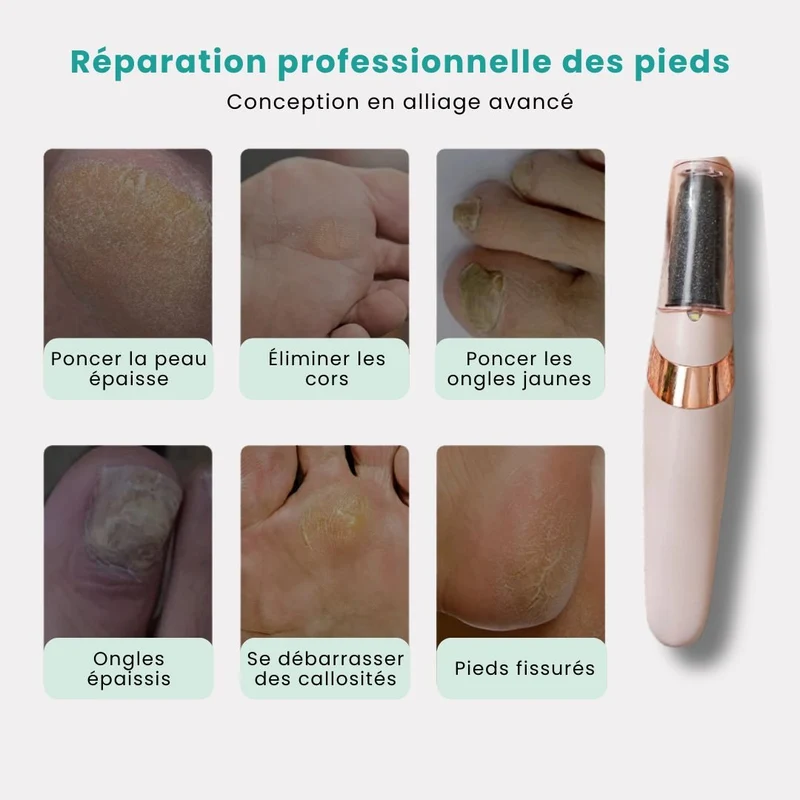 Râpe Électrique Anticalosités – Pieds Doux & Lisses