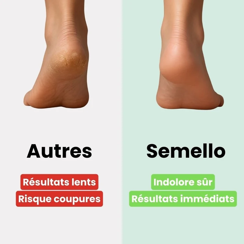Râpe Électrique Anticalosités – Pieds Doux & Lisses