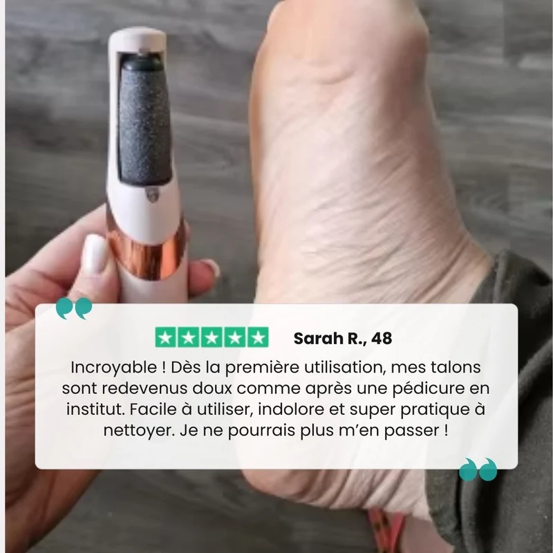 Râpe Électrique Anticalosités – Pieds Doux & Lisses
