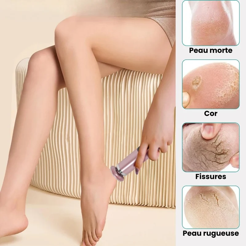 Râpe Anti-Cors Professionnelle | Pieds Doux & Sains