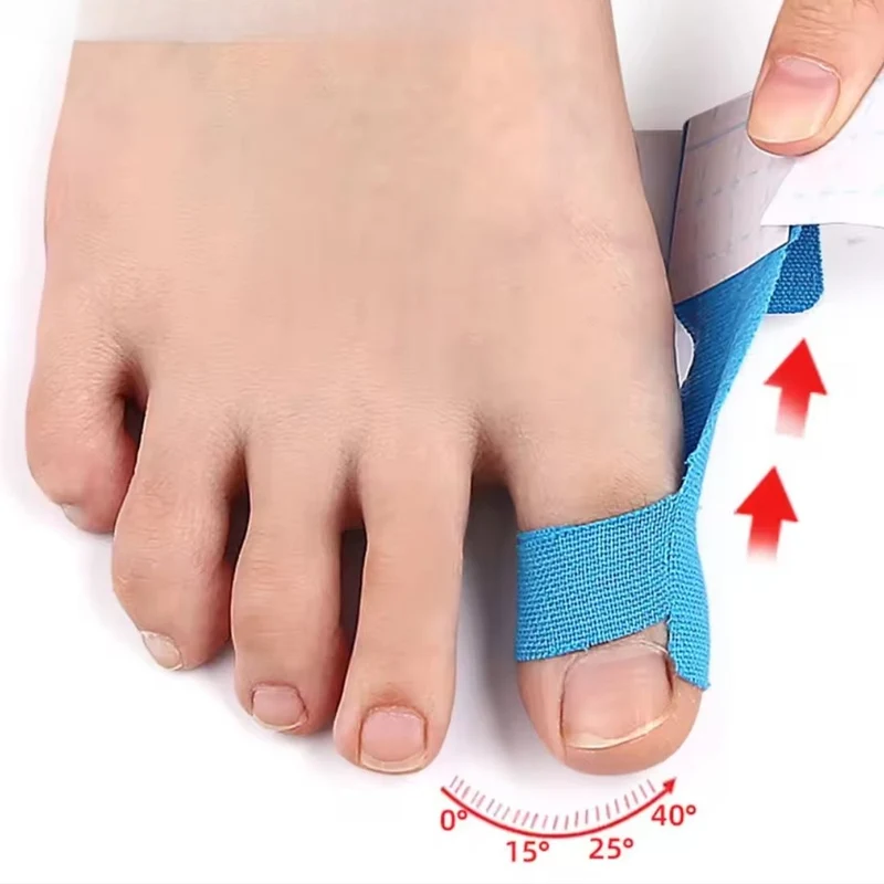 Tape pour Hallux Valgus | Soulagement & Correction