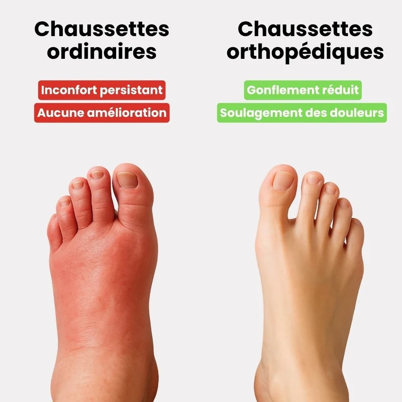 Chaussettes de Compression Thérapeutiques