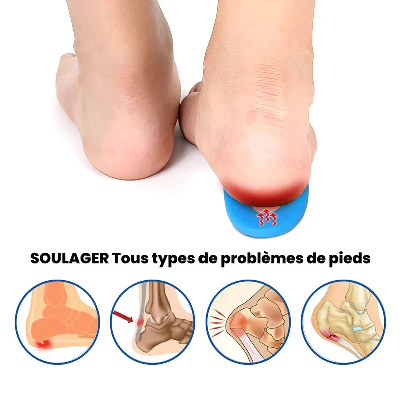 Talonnette Spéciale Épine Calcanéenne en Gel