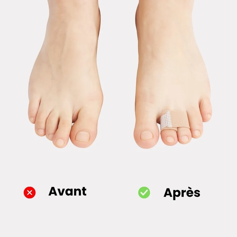 Strap Correcteur Orteil en Griffe
