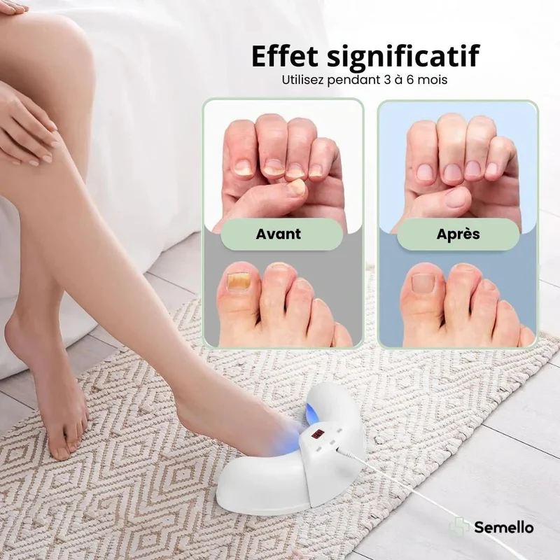 MycoClean™ Traitement des Mycoses aux Ongles