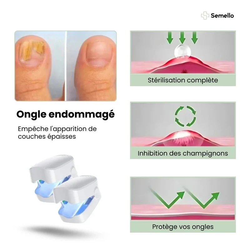 Appareil de Traitement UV des Mycoses