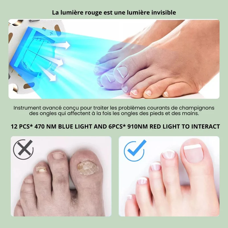Dispositif de Traitement des Mycoses aux Ongles