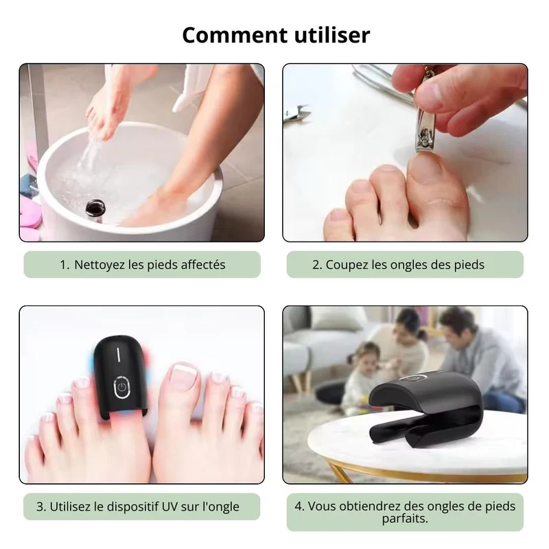 Appareil Anti-Mycose | Traitement UV Rapide à Domicile