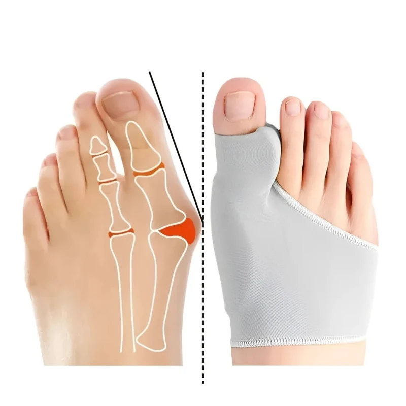 Coffret Hallux Valgus "Prévention & Marche Saine"