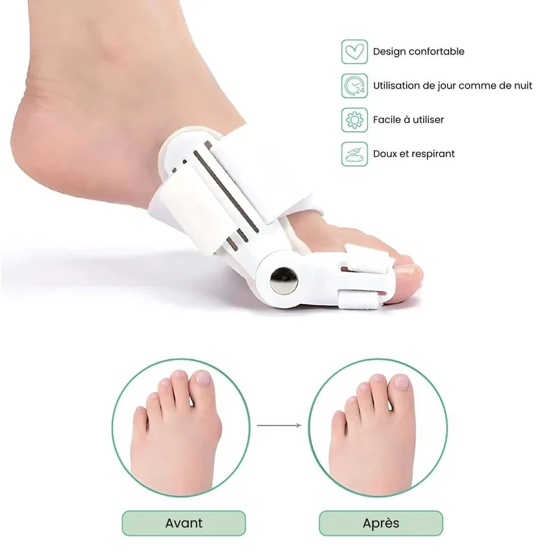 Attelle pour Hallux Valgus | Soulagement Nocturne Discret