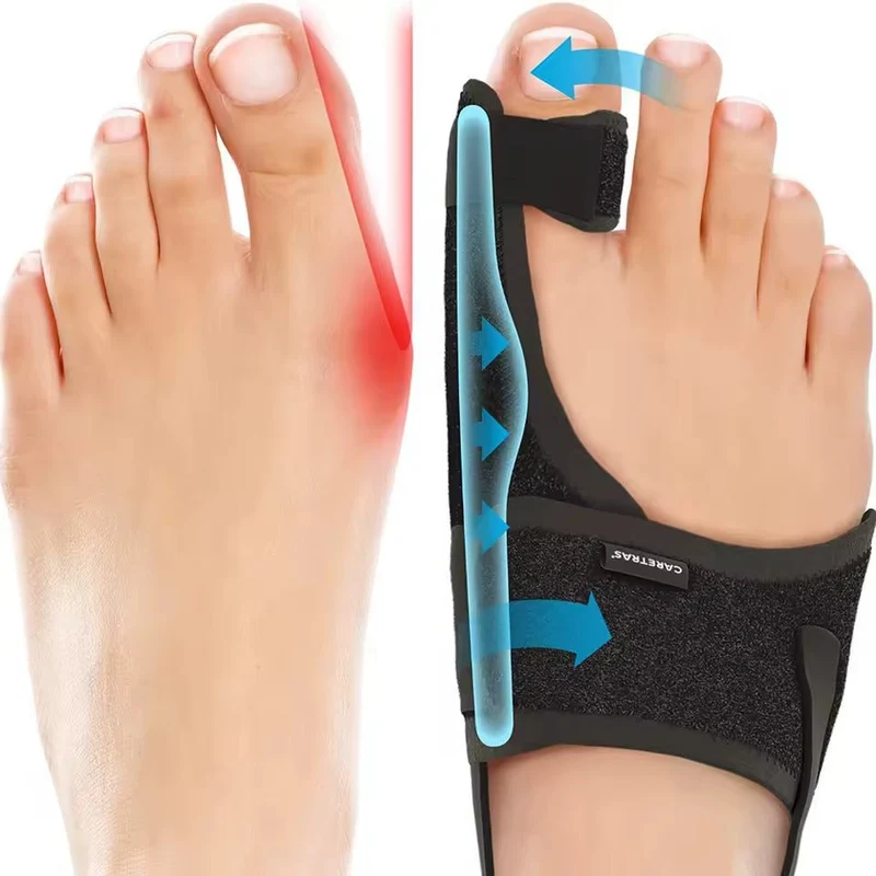 Attelle de nuit pour Hallux Valgus