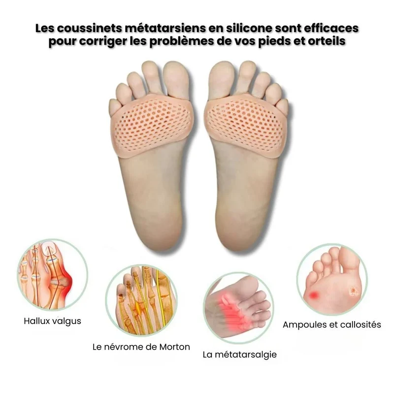 Coussinets Metatarsiens en Silicone (Taille unique)